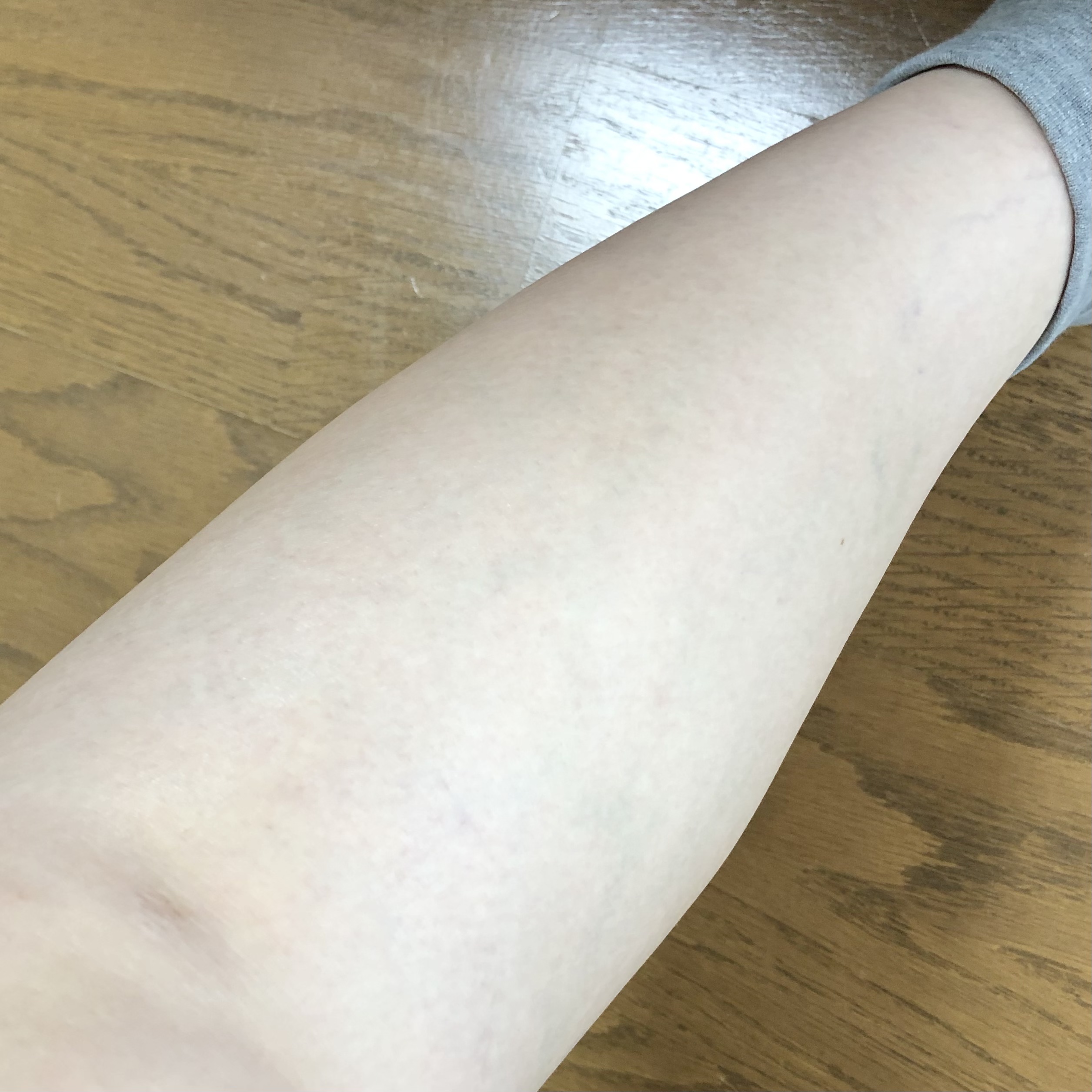 最新画像 コメントお返事 ブラウンの光脱毛器の効果を実感しているけれど 毛根の黒いポツポツが気になる まなきのなるようにするさ